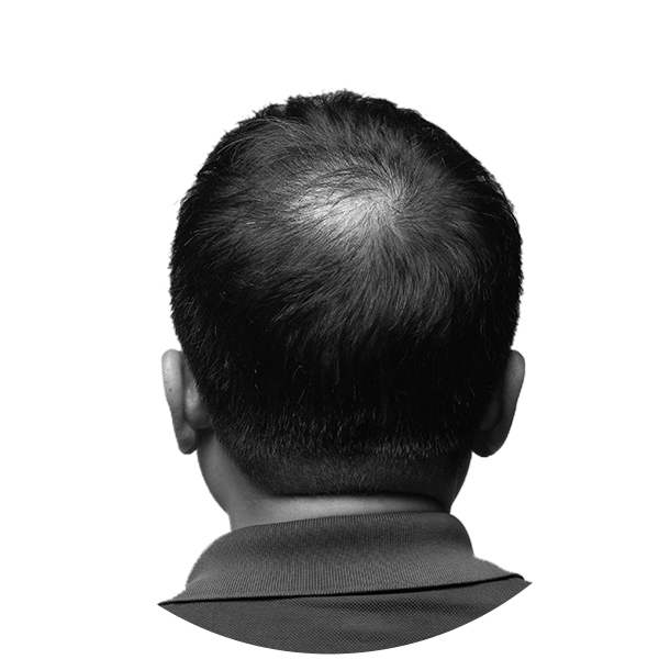 Hairshield-Black-Tablet-For-Men-Alopecia