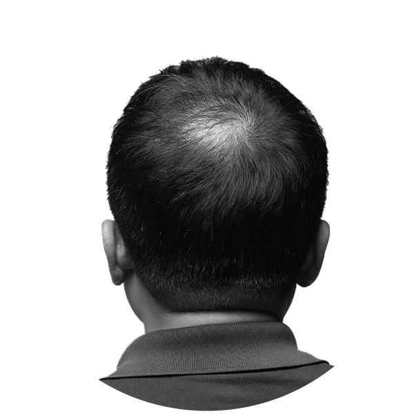 Hairshield-Black-Tablet-For-Men-Alopecia