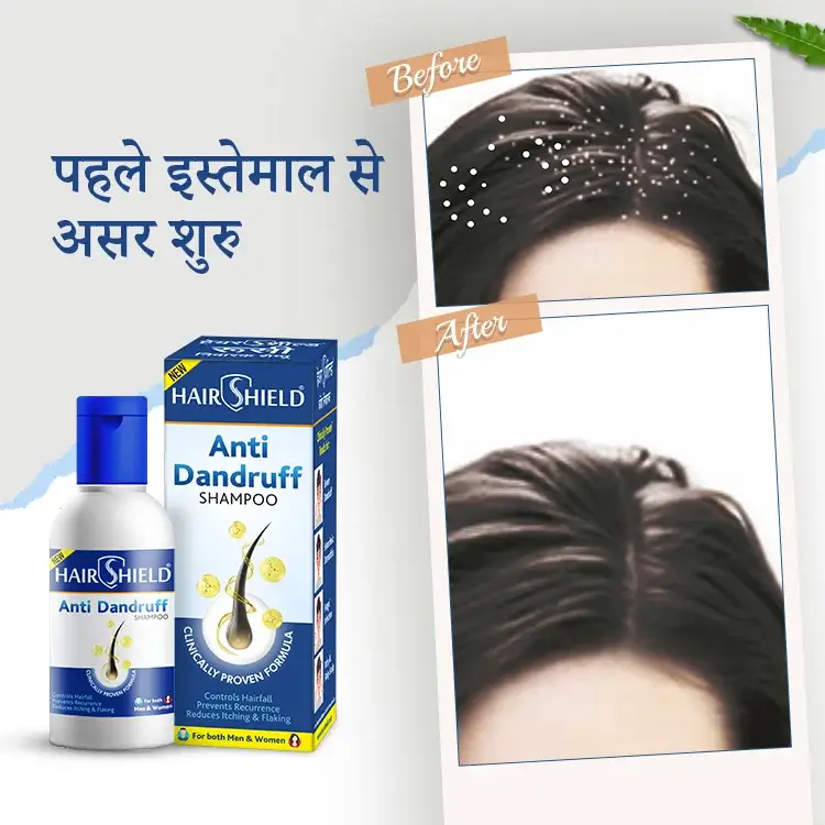 HairShield  Anti Dandruff Shampoo