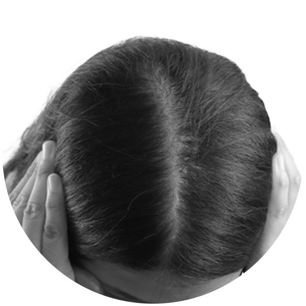 Hairshield-Black-Tablet-for-Women-Alopecia